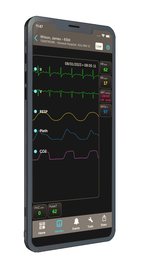 Airstrip workflows patient waveforms